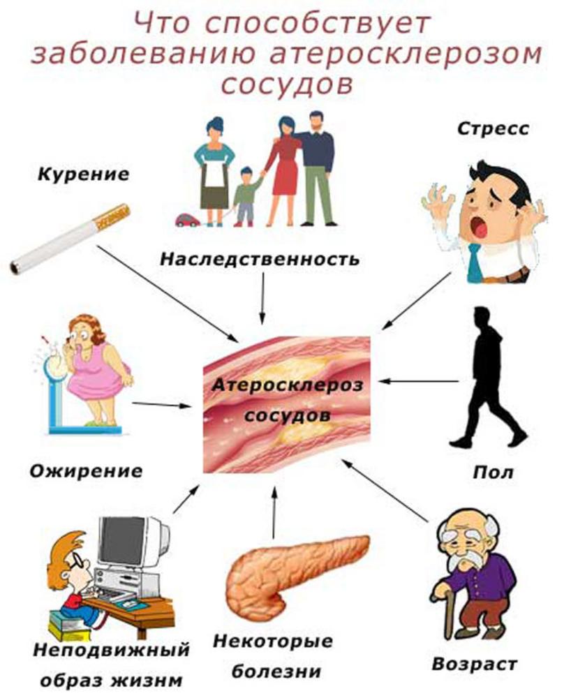 Атеросклероз и его причины