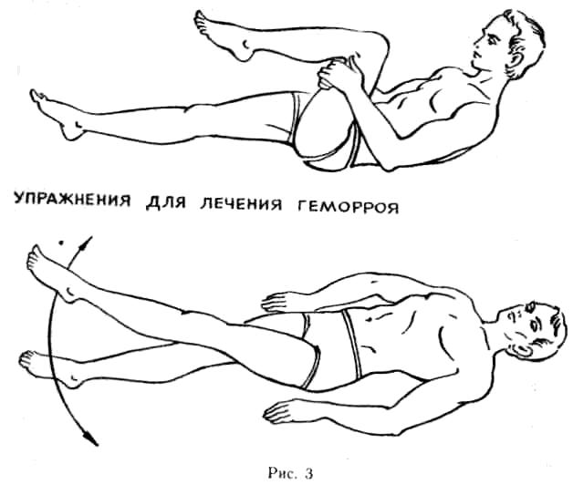 Народное лечение гемороя