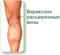 Натуральная терапия для ног