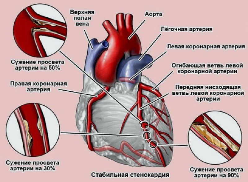 Стенокоридя