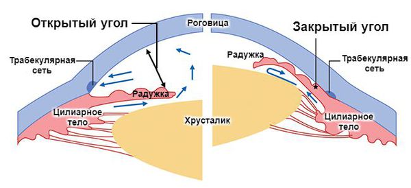 Глаукома